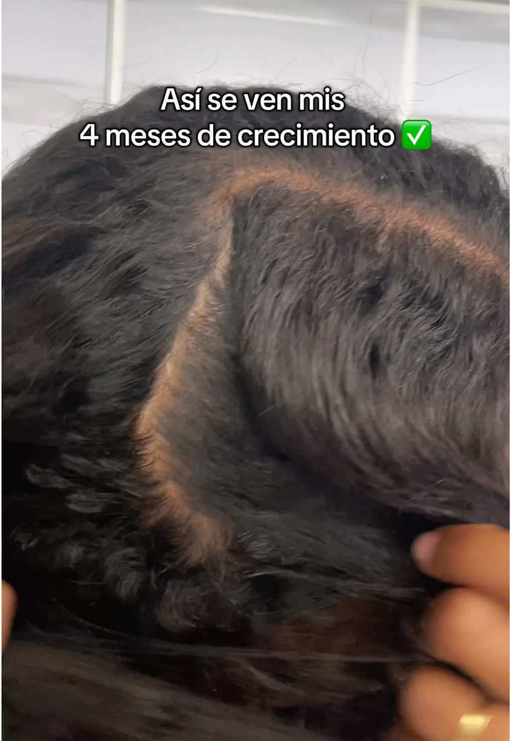 Con unas ganas locas de regresar a mi cabello natural 😮‍💨💆🏾 #cuidadocapilar #crecimientodelcabello #crecimientocapilar 