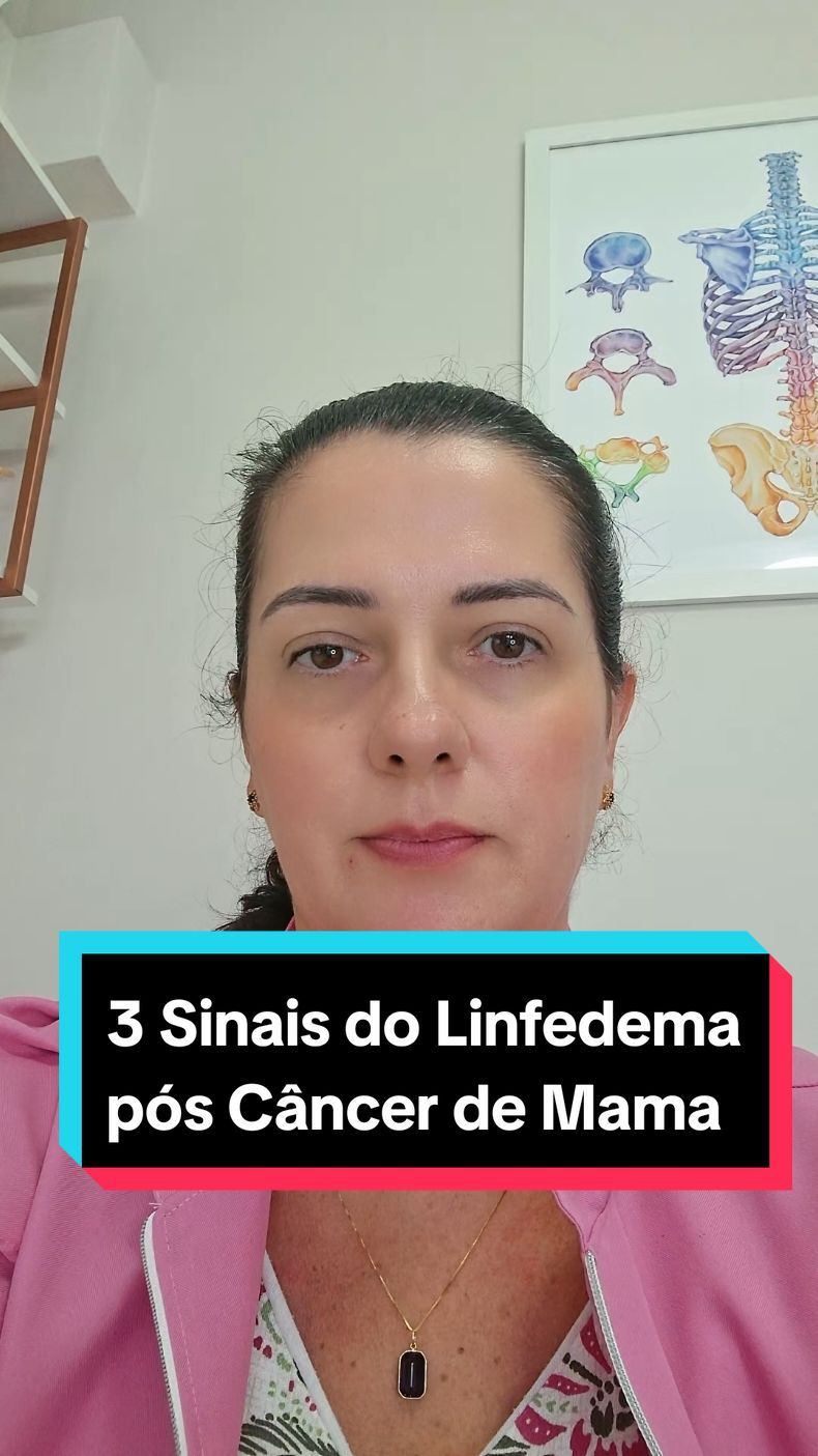 Sinais e sintomas apresentados frequentemente por pacientes que realizaram a cirurgia do câncer de mama, pós esvaziamento linfonodal , parcial ou total. Saiba mais sobre os tratamentos.  Dra. Amanda Altarugio Rivet  Fisioterapia Vascular  #Fisioterapiacancerdemama #cancerdemama #edema #inchaço #linfedema #sequelas #tratamento #fisioterapiadescongestivacomplexa #saúde #cirurgiavascular #mastologia #linfoterapia #fy #foryou