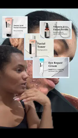 #greenscreen #paratiiiiiiiiiiiiiiiiiiiiiiiiiiiiiii #paratodosdetiktok♡ #creatorsearchinsights #skincaretiktok #acnescars #acne #acneskin #acnesolution #acnetreatments #acneskincare @VGO-Daily care @VGO-beauty 
