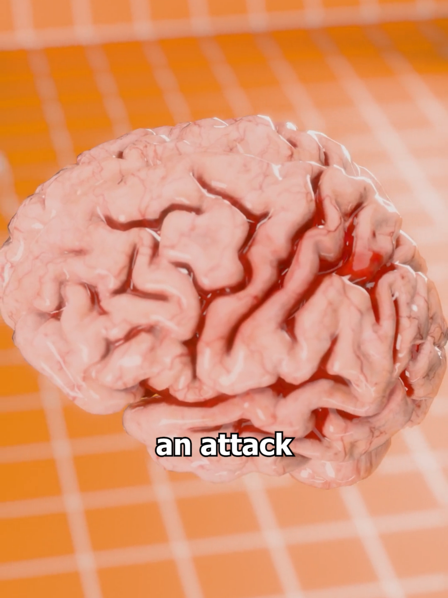 What Happens in Your Brain During Epilepsy? ⚡🧠 Ever wondered what happens inside the brain during an epileptic seizure? 🧠⚡ Your brain runs on electrical signals, but during epilepsy, a sudden surge of abnormal activity can cause uncontrollable movements, vision changes, or even blackouts. Some people may even walk or talk without remembering it! But did you know flashing lights can trigger these seizures? Find out how different brain areas react during an attack and why seizures affect people in such unique ways. Watch till the end to understand the science behind epilepsy! ⚠️ Stay informed, and always consult a doctor for medical advice! #Epilepsy #Seizure #Brain #Health #Neurology #Science #Mind #Medical