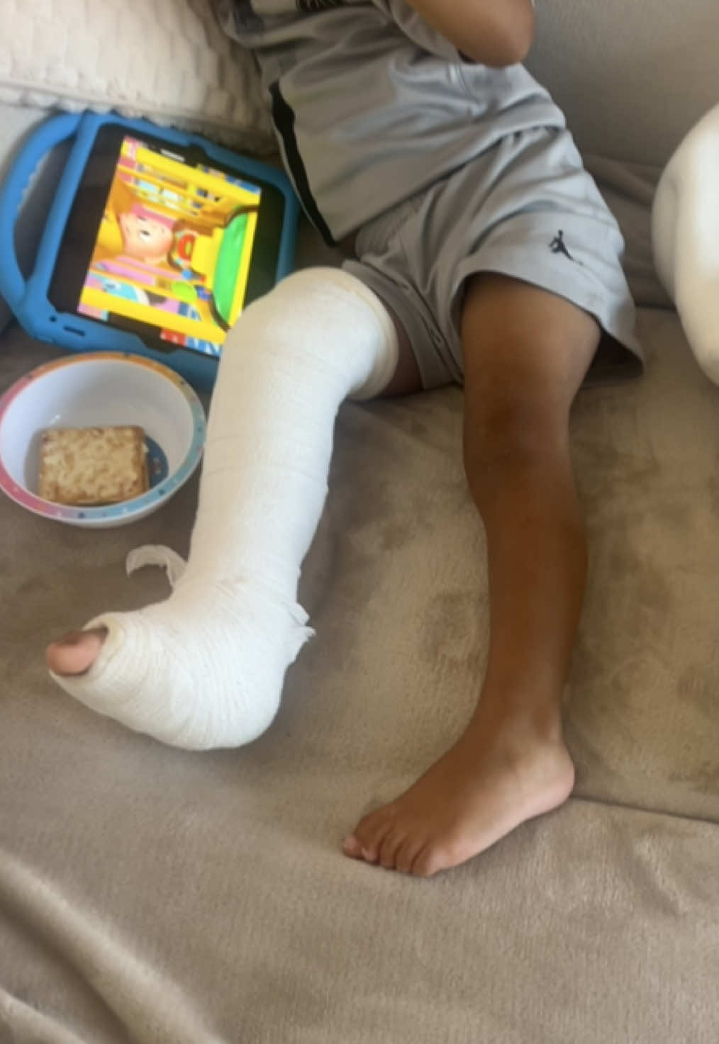 My poor sweet baby broke his leg 😢