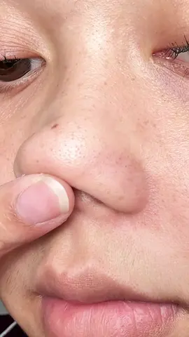 simpel bgt, tapi harus konsisten! ini peeling serum yang berhasil membuat kulitku change jadi lebih glowing🫰🏻✨ #StartsWithYou #peelingserum@YOU Beauty Indonesia 