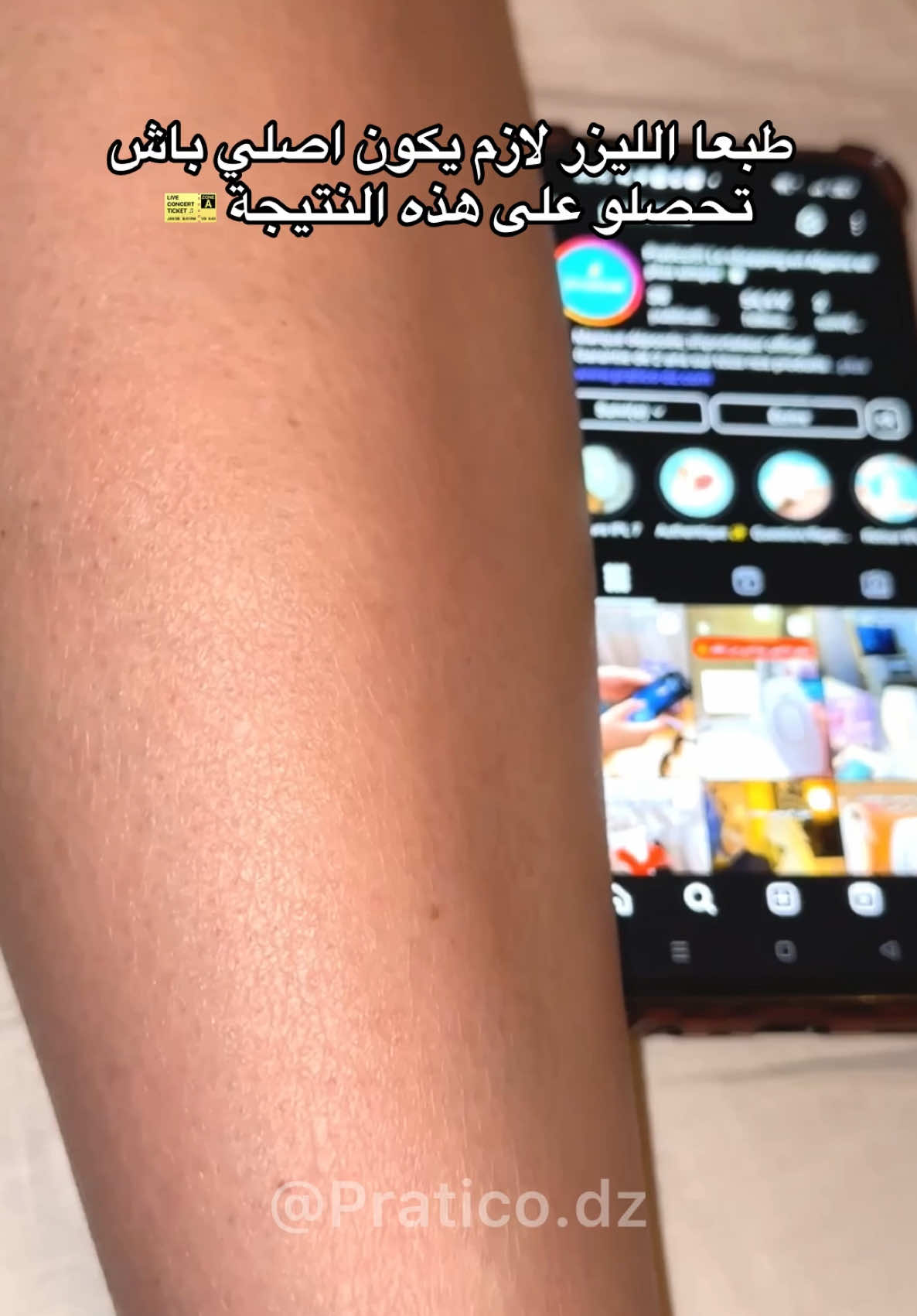 صديقتي عرسها بعد العيد و باش تكون مهنية قبل عرسها و جهازها تشريه و هي مرتاحة ❤️ و نتيجة استعمال الليزر المنزلي على الشعر الزائد في جسمها تلقاوها في الفيديو ✨