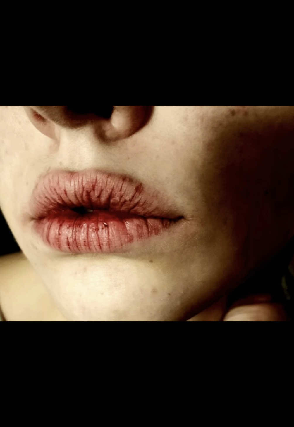 #beauty #humanbody #scars #human #Beautiful 