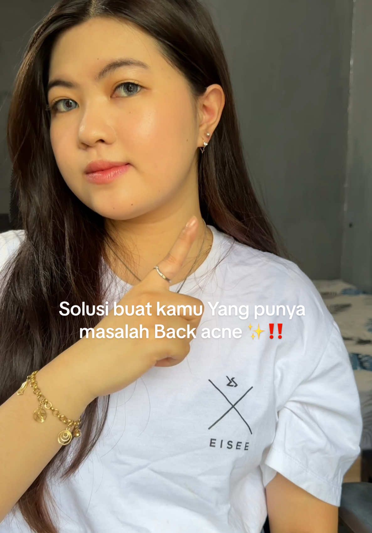 Yang punya masalah seperti di vid  pokonya wajib sih punya produk ini ✨🙂‍↔️ #jevarine #backacne #acnebodylotion#jevarine#bodycare #bodycareroutine #bodycareproducts #bodycareviral #acne #acnetreatment @By Jevarine 
