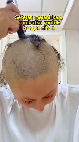 Jumlah rambut tipis,jangan lagi buang uang peruma,cobalah cara ini #rambuttipis #rambutrontok #remimpihairfall #ramadanekstraseru
