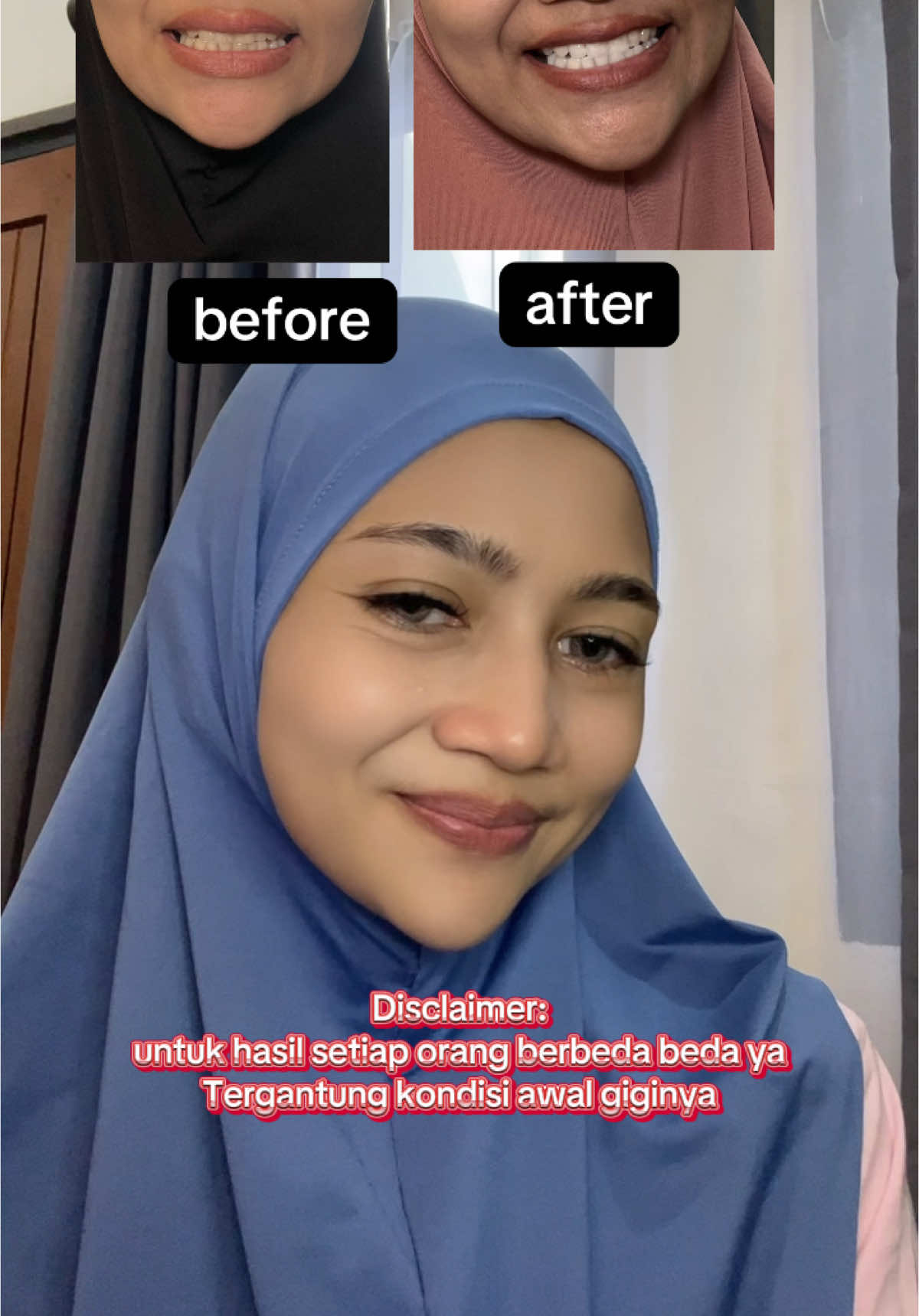 Siapa nih yg giginya mau jadi lebih putih? Nah ini dia solusinya ya pakai pasta gigi dari @OralCyberX Indonesia Shop dan rasakan manfaatnya👌 #pastagigipemutih #pastagigi #oralcyberx #pastagigixylitol #pastagigiprobiotik #pastagigioralcyberx #gayahidupsehat #gayahidupbersih #Lifestyle #fyp #fypシ゚ #fyppppppppppppppppppppppp 