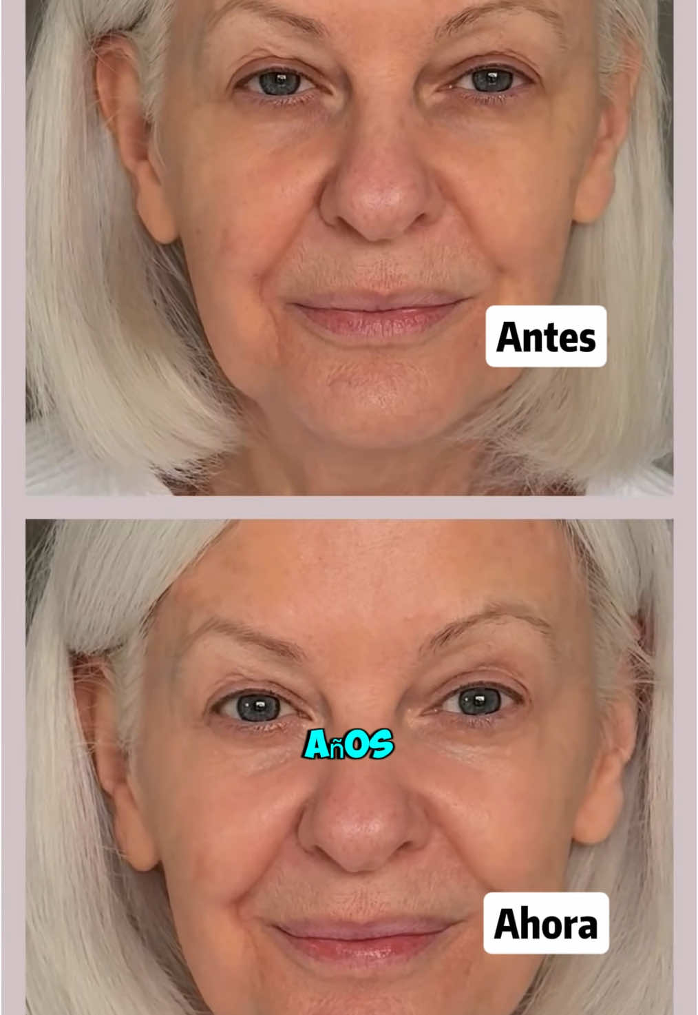 ¡El secreto para vencer el tiempo! #antiaging #healthy #nad #blueberry #lutein #carrot #greentea #aminoacids #disclaimer #saludable #supplements #wrinkles #resultsmayvary #skin #forehead #antiagingtips #acne 