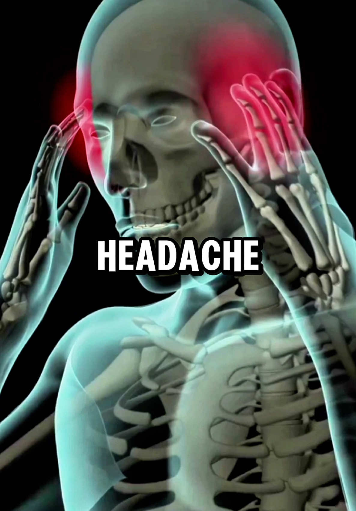 Why Your Head Hurts 🧠⚡️  #health #healthtips #healthylifestyle #viral #realhealth #Fitness #headache #migraine 
