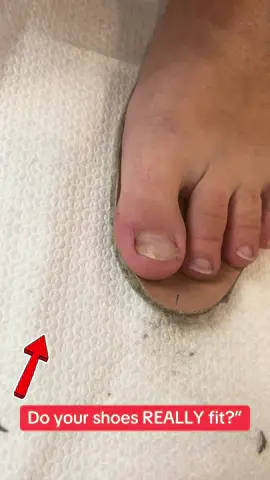 👉 Take out the insole and step on it. 🚨 If your toes go over the edge, your shoes are TOO narrow! 🔍 Check your shoes and tell me in the comments – do they fit? @Buci Barefoot  #ShoeFitTest #FootHealth #CheckYourShoes #ToePain #IngrownNail #BarefootShoes #FootCare #DidYouKnow #HealthyFeet