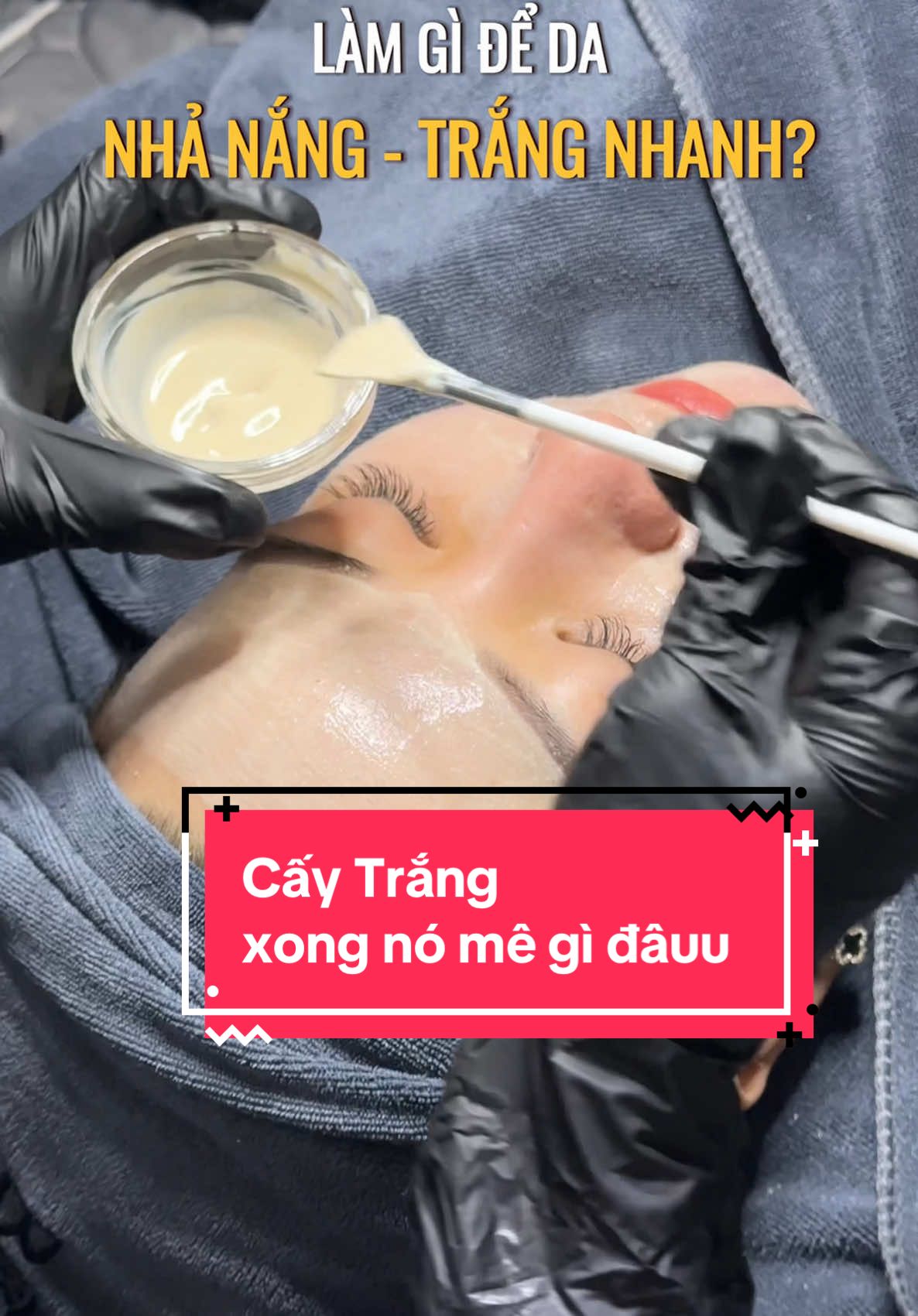 Cấy trắng xong, nó trắng, nó mướt da, nó đã gì đâuuu á 😙😙  #bovisspa #spauytin #spauytindanang #spadieutrimun #spadieutri #spadieutridachuyennghiep #spadieutridauytin #spadananguytin #spadanangchuyendieutri #peel #chemicalpeel #peelda #duocmypham #d#dượcmyphams#spadanangdieutrit#trehoadas#spas#skincares#skincareroutines#spatrimun