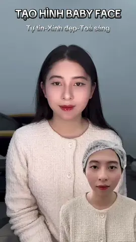 Chỉnh j chưa các c iu🥰#tiêmfille #tiêmfullface #FillerCollagen 