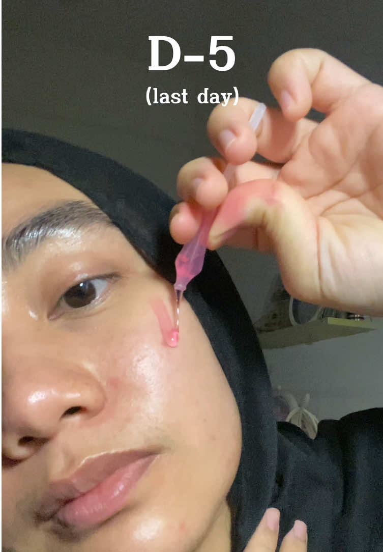 @medicube Malaysia  #Medicube #Medicubemalaysia #Medicubemy #PDRNOneDaySerum #5daysglowupchallenge #5dayschallenge #Glowupin5days #BrighteningGlow #PDRNserum #ViralSkincare #SkincareViral