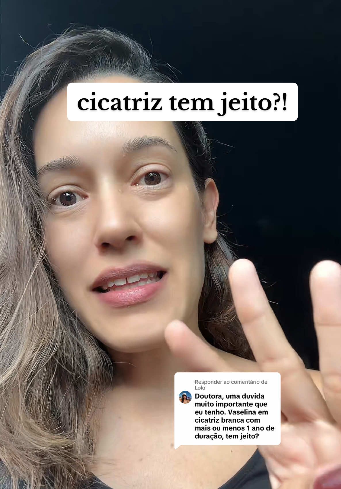 Respondendo a @Lolo meus tratamentos preferidos: laser fracionado ablativo, não ablativo e laser de picossegundos combinados. #cicatrizes #queloides #cicatrizesdeacne #cicatrizacao #cicatriz  @gardeniadermato  @gardeniadermato 