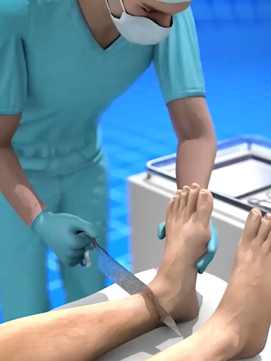 #Anputacaope#curiosidades_varias 