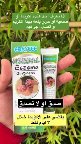علاج الاكزيما في ٣ ايام فقط!!!#الرياض_الان #مكة #جدة #السعودية🇸🇦 #تجربتي 
