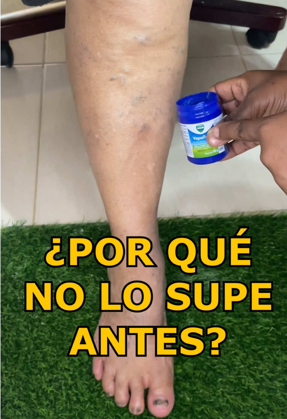No quieren que sepas esto. Haz esto solo si tienes arañitas y Várices #trucostiktok #tiktokviral #pies #recetasparatucasa 