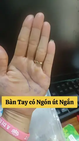 #xemchitay88 #xemchitay  #Ngón út ngắn