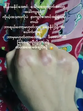 နံရံကိုထိုးလိုက်လို့ လက်နာသွားတာတောင် ငါဟာနာလို့နာမှန်းမသိခဲ့ဘူး ရင်ထဲက အနာက လက်နာတာထက် ပိုနာကျင်ပြီး ပိုခံစားရတယ် ပိုပူလောင်ရတယ် အချစ်ရယ်  #ဗန်ဗန် #viral #views #flypシ #foryou #foryoupage #tiktok #CapCut #crdစာသား 