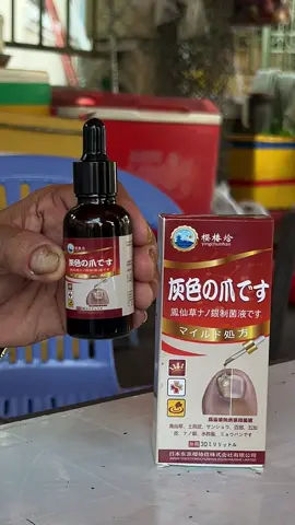 nấm móng, thúi móng hư khóe không còn là nỗi lo với e serum Kannedo này đây ạ