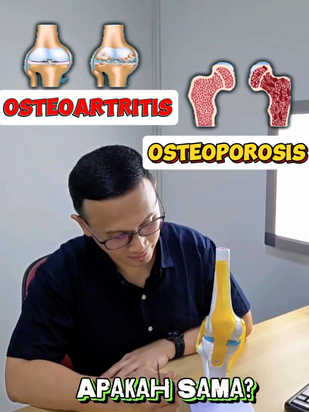 Osteoporosis : Adalah  Pengeroposan tulang yang menyebabkan berkurangnya massa tulang dan kerusakan jaringan tulang, akibatnya akan meningkatkan risiko terjadinya patah tulang.   Osteoartritis : Adalah Pengapuran tulang rawan sendi dan tulang di bawahnya yang menimbulkan keluhan nyeri dan kekakuan sendi, sehingga mengurangi mobilitas dan fungsi sendi #dokternyeri #dokternyerimagelang #osteoarthritis #osteoporosis #edukasikesehatan 