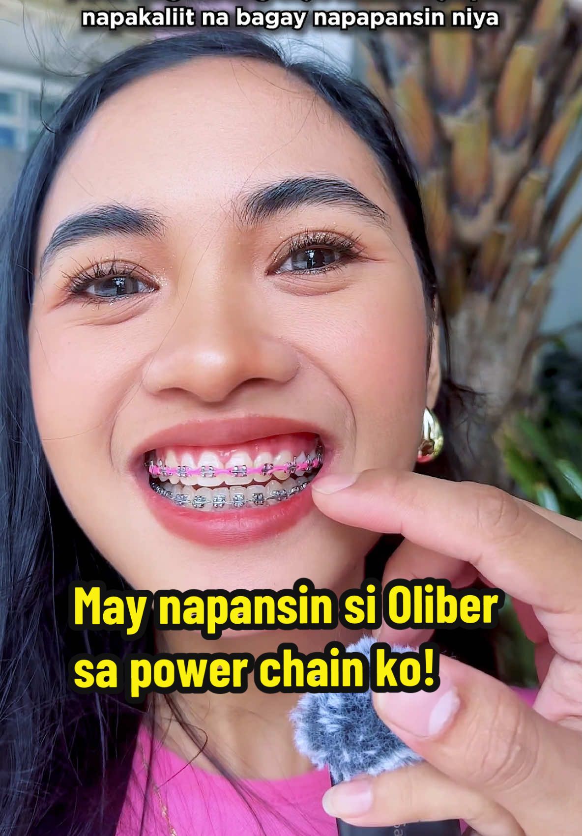Grabeng titig naman kasi yan oliber HAHAHAHA #braces #bracesupdate #powerchain #fyp #pink #hotpink #bracesjourney #teethtok #camillevelasco #fbreels #couple #couplemoments 