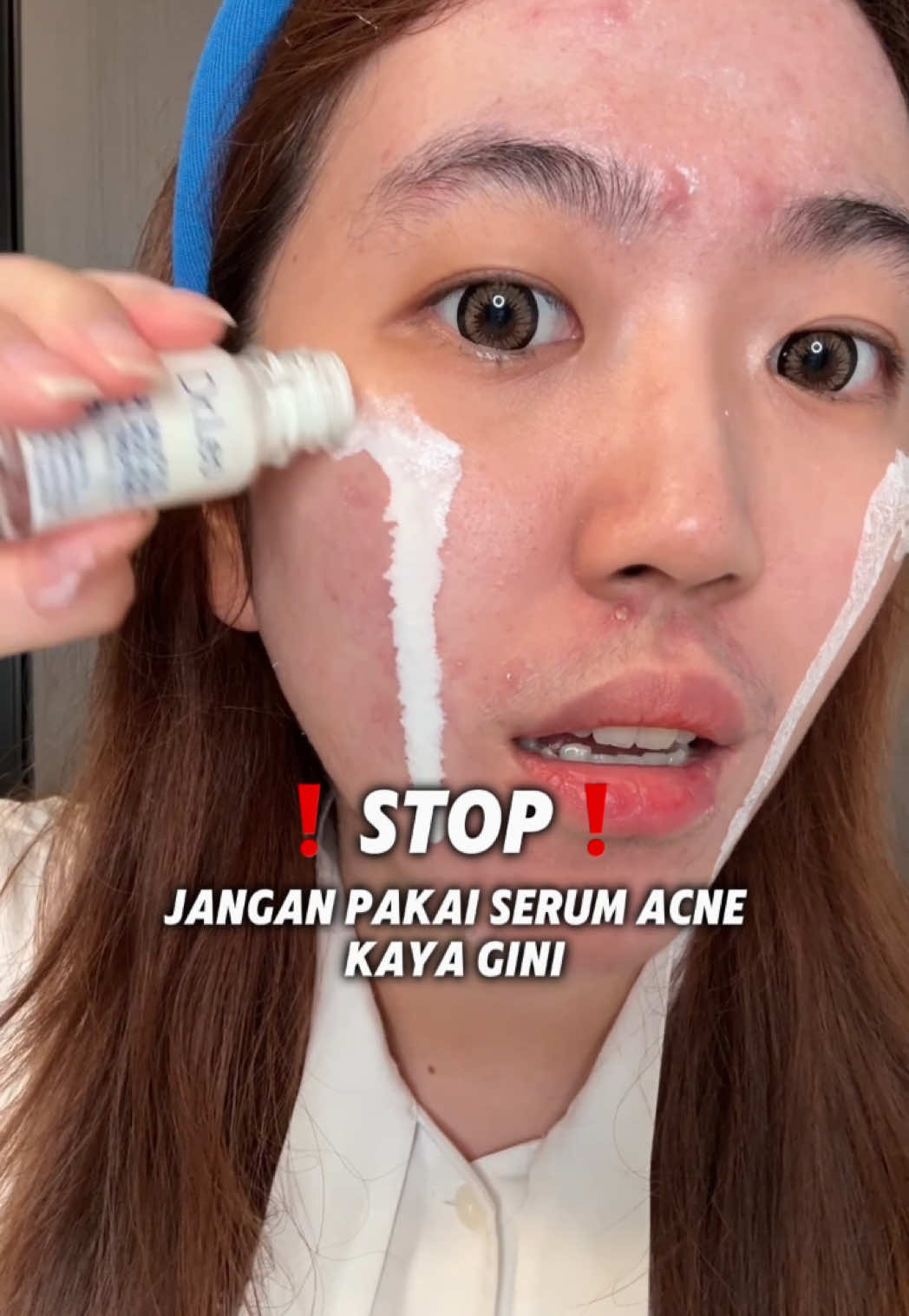 WAJIB PUNYA!! Siapa yang masih struggle sama jerawat? Coba deh Dr Leo Acne Spot ! Jerawat mereda 😍✨ @Dr.Leo-USA #drleoid #drleoacneessence #skincareindonesia