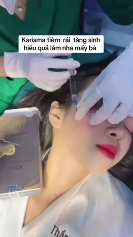 #beautyqueen #tăngsinhcollagen #môibaby 