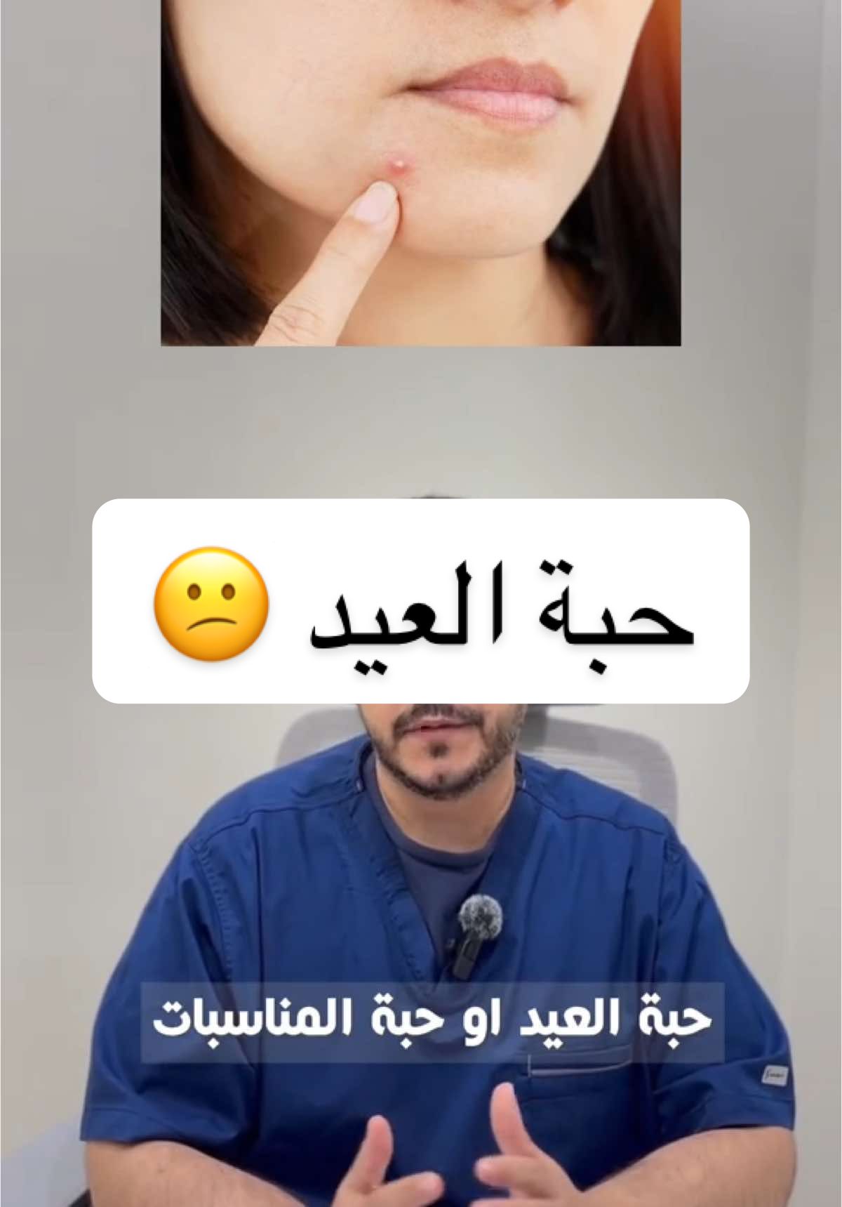 حبة المناسبات اسبابها وطرق علاجها #كريم #حبة_العيد #حبة_المناسبات #علاج_الحب_أثار_الحب #بثور_الوجه #حبوب_الوجه #مرطب #السالسيليك #اكرتين #fyp #تجميل 