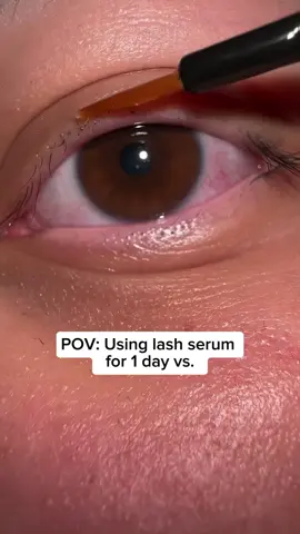 The best lash serum I’ve tried 