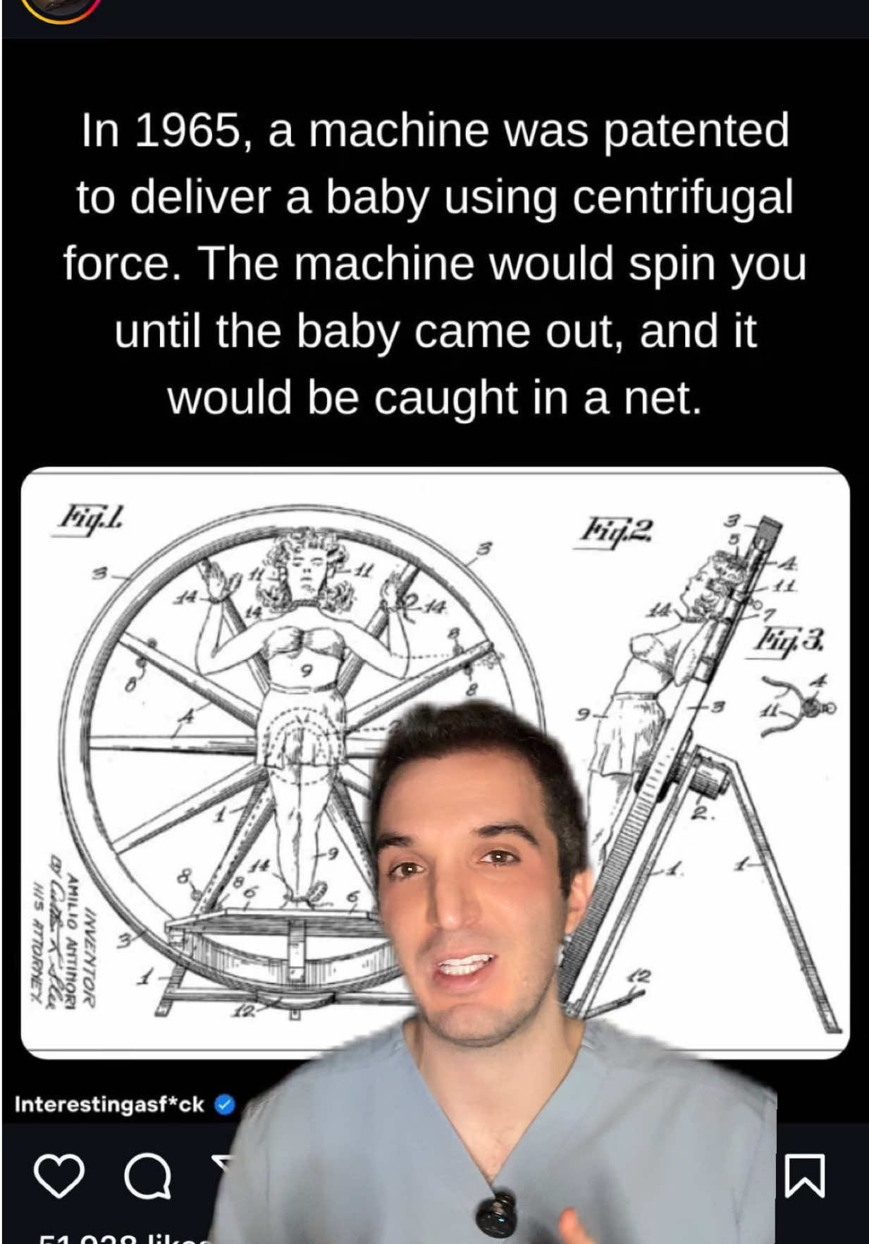 OBGYNs, how’s this delivery technique? George and Charlotte Blonsky, a married couple, filed a patent in 1965 for an 