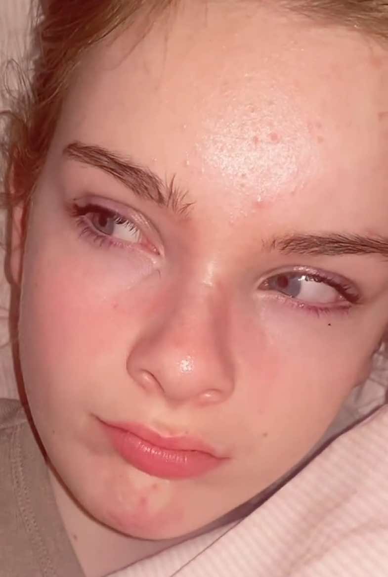 My face looks weirdly smooth #fyp #foryou #london #travel #viral #blowup #pretty #late #beauty #looksmax #looksmaxing #dejavu 