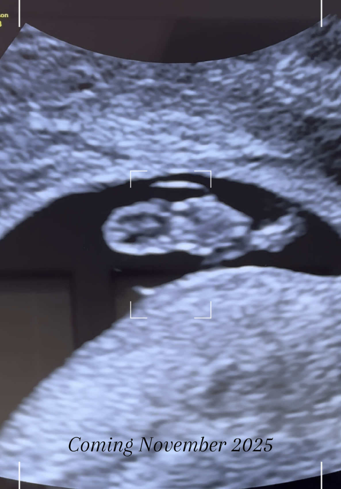 So blessed. We prayed for this and tried for months. Almost seems unreal. Thank you Jesus! #pregnancy #7weekspregnant #1sttrimester #ultrasound 