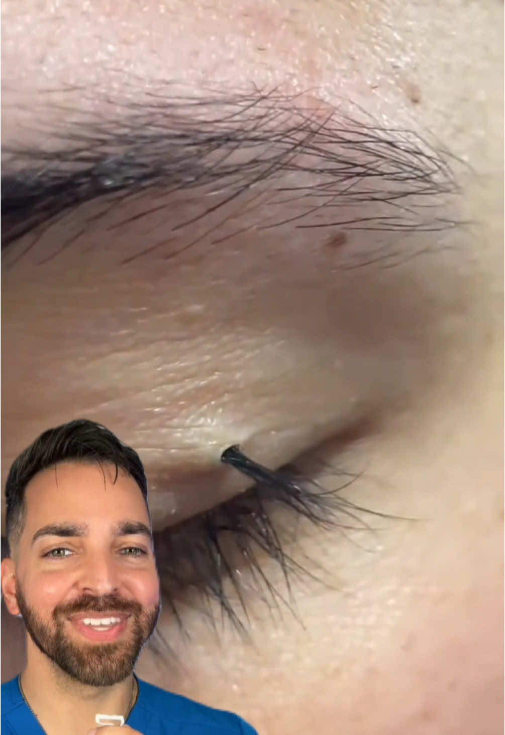 Could you resist tweezing it?
