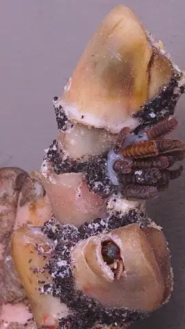 Unbelievable Toenail Fix in the USA! 🇺🇸 #USA #AmericanToenail #ToenailCare #SatisfyingNail #NailFixUSA #AmericanHealth #USAToenailCare #MadeInUSA #TrendingInUSA Disclaimer: These videos are sourced from other platforms, Video Credit to Vietnamese group. They feature artificial toenails for educational and monetization purposes.