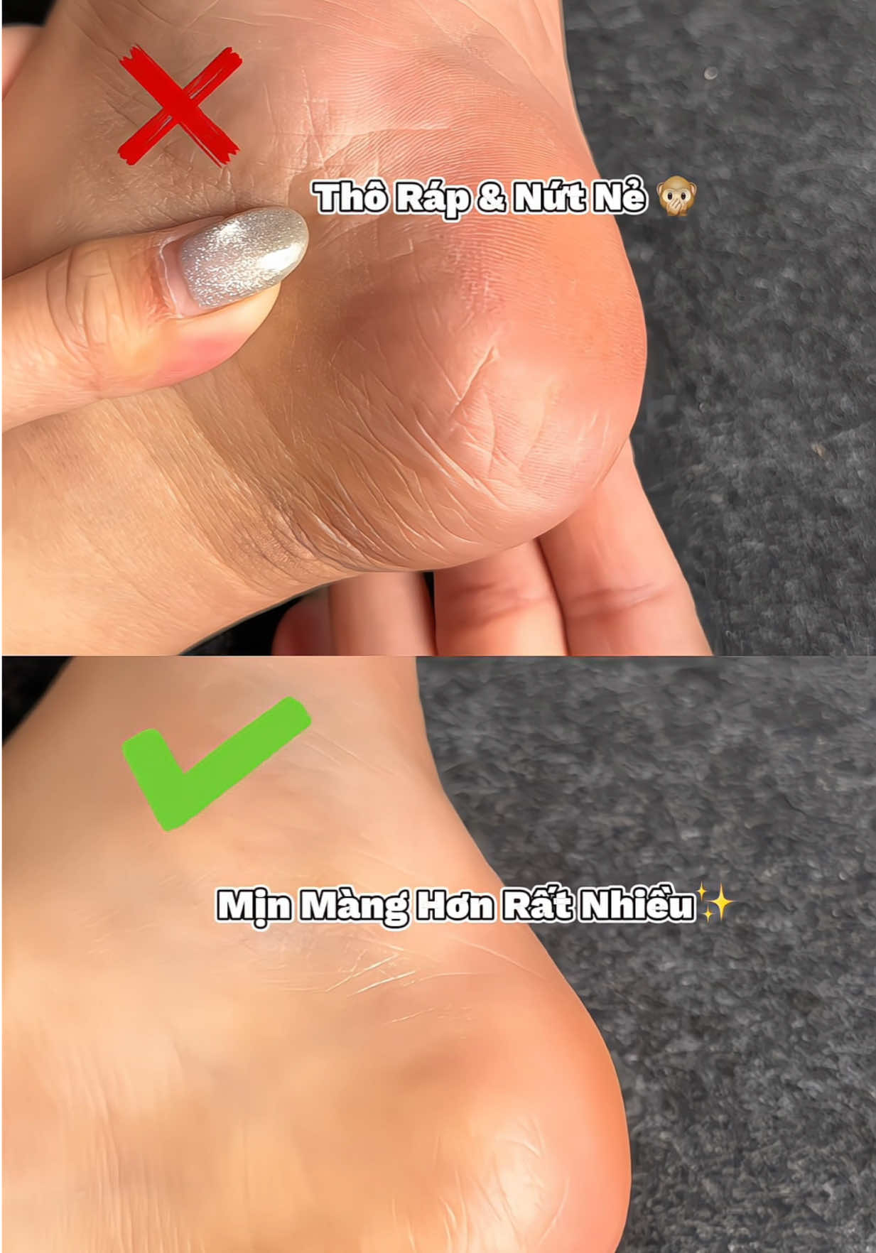 Combo Chà Gót Chỉ Hơn 70K thôi mn ơi tranh thủ ring về đi ạ #chagotchan #chagotchantainha #chagotchaninox #chagotchaninoxtainha #caychagotchan #caychagotchaninox #byntchuyengiadung 