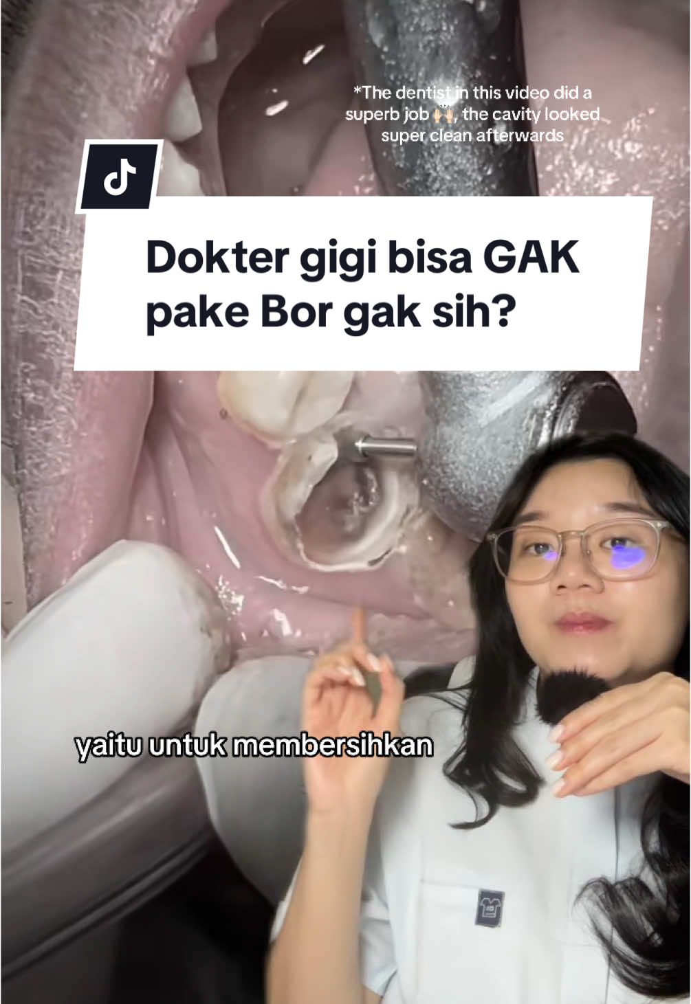 #duet with @Dr.Morad.Shaglouf gak kuat denger suara bor gigi tapi mau gak mau harus dilakukan, ini alasannya 😱 #doktergigi #dentalcare #cariesdental #gigiberlubang #sakitgigi #tambalgigi #restoration 