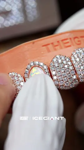 Opal grillz on the process ! #icegiant #grillz #theigtgrillz #customjewelry #hiphopjewelry #viral #leozinbeats #dentes #ouro #sorriso #joiadental #facetas #dentedeouro #jewelry#fyp#page#diamond#goldjewelry#jewelrytiktok#rapper#icedout#toothgems#fashiontok#inlove#toothgem#grillzqueen#teeth#foryoupage#trending#braces #orthodontist #viral #reaction  #dental