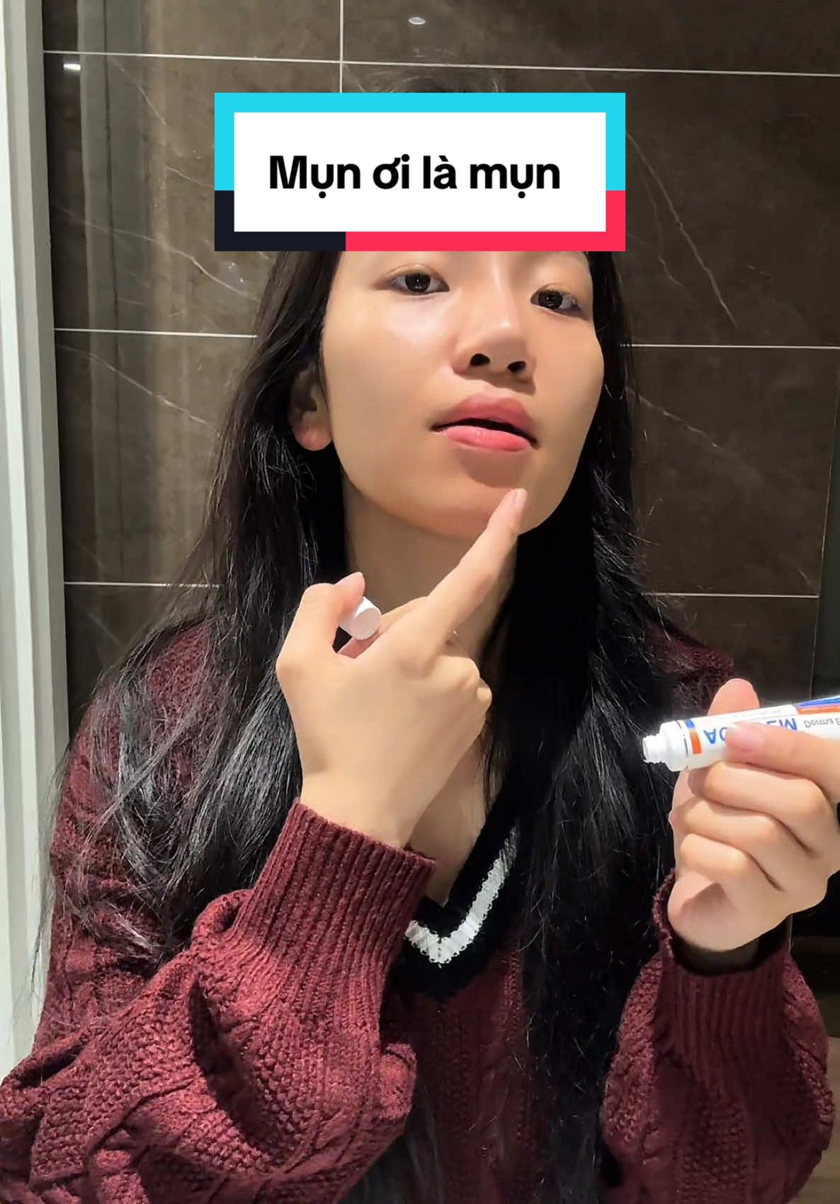 Mụn ơi là mụn #actidem #seehi #xuhuong #fyp #makeup 