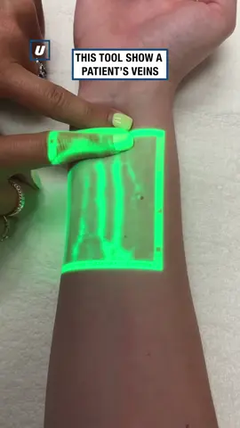 #рекомендации #рек #медицина #вена #биология #medical #процедурнаямедсестра #медсестра #врач 