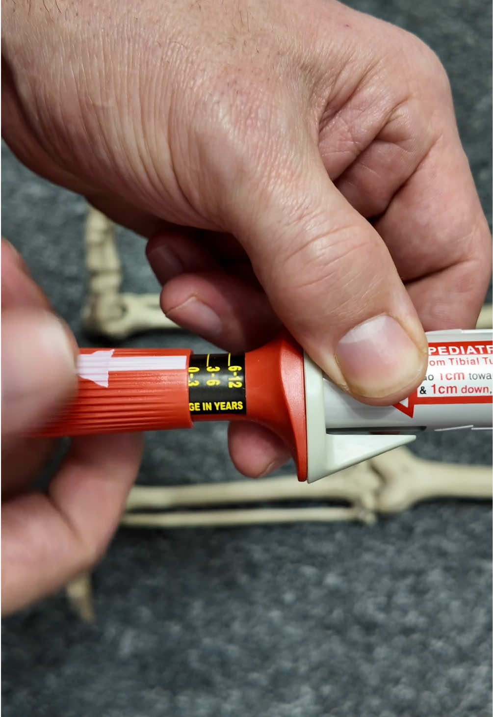 WKŁUCIE DOSZPIKOWE DLA DZIECKA — CO TO ZA URZĄDZENIE?