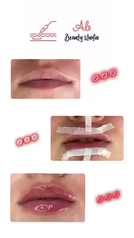 #kiss💋 #labiosperfectos✨ #abbeautystudio✨👩🏼‍⚕️ #citasdisponibles✅ 