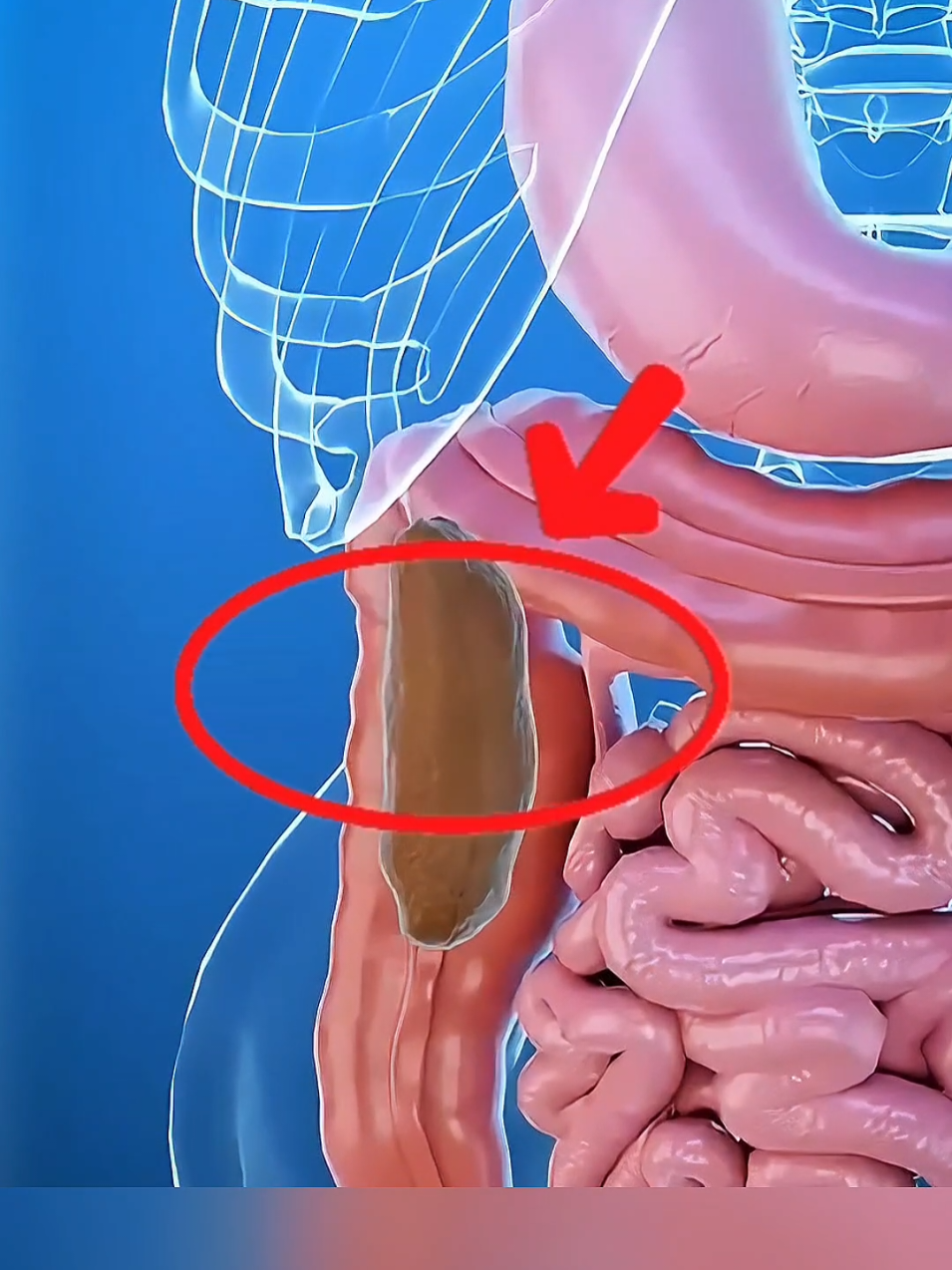 se suas fezes estão assim, tenha cuidado  #fezesescuras #saudeebemestar #fezescomsangue #saude #feze #saudedamulher #Saude #fezes 