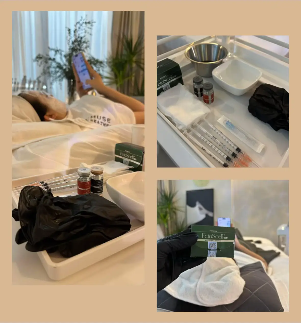 𝐅𝐞𝐭𝐨𝐬𝐜𝐞𝐥𝐥 - 𝐌𝐞𝐬𝐨 𝐦𝐮̣𝐧 / 𝐠𝐢𝐚̃𝐧 𝐦𝐚𝐨 𝐦𝐚̣𝐜𝐡 / 𝐝𝐚 𝐤𝐢́𝐜𝐡 𝐮̛́𝐧𝐠 FetoScell Regeneration không chỉ là một dòng Meso thông thường. Với hơn 98% tế bào gốc từ nguyên thể và hơn 6 tỷ Exosome được chắt lọc từ những nguồn tế bào trẻ, tinh khiết nhất, sản phẩm này mang đến sức mạnh tái tạo đáng kinh ngạc. Thay vì sử dụng Exosome từ tế bào gốc trưởng thành, công thức đột phá của FetoScell Regeneration kết hợp NK Cell x NAD x Exosome – một công thức tiên phong, tập trung giải quyết tận gốc các vấn đề: 🔻 Mụn viêm trên làn da nhạy cảm. 🔻 Da yếu, mỏng, giãn mao mạch. 🔻 Tình trạng thâm sau mụn và nguy cơ mụn tái phát. Lý do khách hàng sẽ yêu thích FetoScell Regeneration:  • Giảm viêm nhanh chóng: Chỉ sau vài buổi, làn da mụn nhạy cảm sẽ thấy rõ sự khác biệt.  • Phục hồi tối ưu: Hỗ trợ tái tạo da tổn thương, cải thiện kết cấu da mỏng yếu.  • Ngăn ngừa mụn tái phát: Giúp làn da khỏe mạnh, giảm nguy cơ mụn bùng phát sau liệu trình.  • Hiệu quả rõ rệt: Khách hàng cảm nhận sự thay đổi chỉ sau 1-2 liệu trình. #spa_uytin_ #lamusespanhatrang #xuhuongtiktok #dieutridakhoahoc #xuhuong #MTS #acneskin #detox #Peel #Ủtrắng #meso_cangbongda #Exosome #SpaNhaTrang 