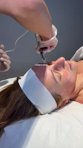 We're in full anti ageing mode today 😜 #microneedling #melbourne
