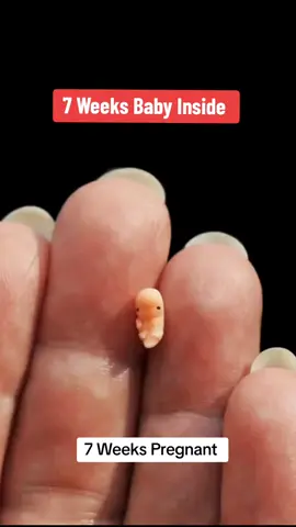 7 Weeks pregnant | 7 weeks baby Size #viralvideotiktok #viralvideos #pregnancyjourney #7weekspregnant #7weeksold #babysize #7weeksbabysize #viralvideo #viraltiktok 