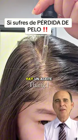 Si tú también sufres de caída del cabello, no te lo pierdas#batana #hair #haircareroutine #hairtutorials#alopecia #TikTokShop #growthoil#hairlosssolutions #growth#longhair#fyp#foryoupage#springtok#shopvideccamival