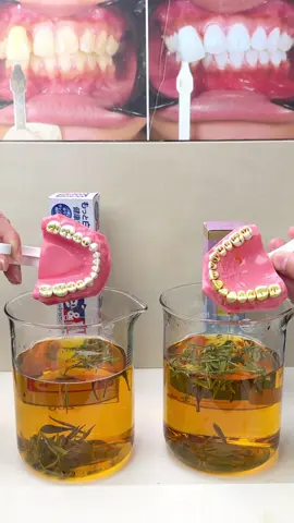 How To Get The Whitest Teeth In The World! 😬🦷 #Toothdecay#toothpaste#niacinamide#yellowteeth#bodyaccel#whiteningteeth