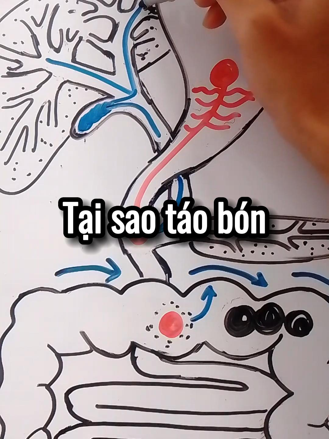 Tại sao táo bón *Ngoài ra theo Đông Y mà tôi có đọc qua, người ta nói rằng táo bón là do thận âm hư. Mọi cơ quan trong cơ thể điều có liên hệ mật thiết với nhau. Theo Đông Y, thận là tinh hoa của Lục Phủ Ngũ Tạng. Tại vì thận là nơi nhận tất cả. Thận trong đông y thuộc hành thủy, nhận lấy âm tinh của lục phủ ngũ tạng mà tàng giữ lấy, là gốc của các tạng