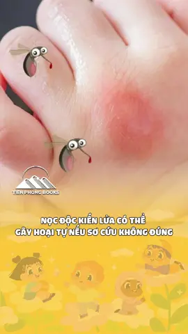 Sơ cứu cho trẻ nhỏ đòi hỏi sự hiểu biết đặc biệt về cách cơ thể trẻ phản ứng với những tổn thương. Cuốn sách này sẽ cung cấp cho bạn những phương pháp sơ cứu hiệu quả để bảo vệ sức khỏe của con yêu trong mọi tình huống...! #tienphongbooks #socuu #meoidunglo #socuutreem